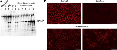 Expression of SRP-9001 dystrophin and stabilization of motor function up to 2 years post-treatment with delandistrogene moxeparvovec gene therapy in individuals with Duchenne muscular dystrophy